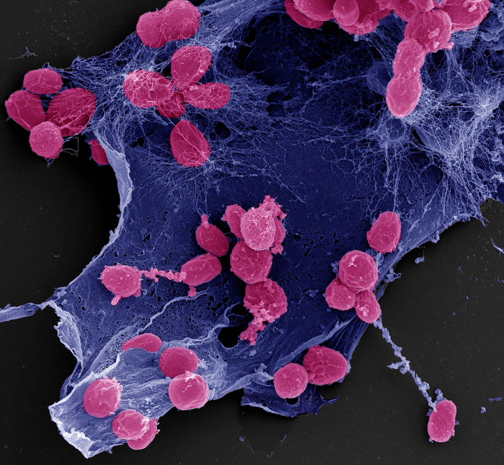 Rasterelektronenmikroskopische Aufnahme von Stieleria maiorica. Zellen in pink. Matrix in blau. (Foto: Manfred Rohde/HZI) 