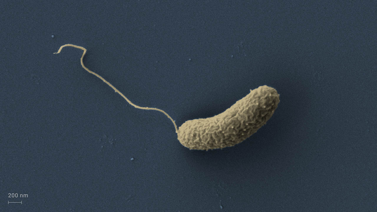 Elektronenmikroskopische Aufnahme eines Cholera-Erregers Vibrio cholerae (nachträglich koloriert). Foto: Kai Papenfort/Liana Franke
