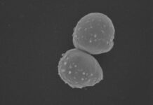 CPR im Labor: Jenaer Team kultiviert Grundwasser-Bakterien Forscher aus Jena reichern schwer kultivierbare CPR-Bakterien aus Grundwasser an. Neue Erkenntnisse zu Sauerstofftoleranz und Ökologie öffnen Forschungswege. Foto: Aufnahme eines Rasterelektronenmikroskops von winzigen Zellen aus Grundwasserproben, die im Labor kulturviert wurden (Quelle: Elektronenmikroskopisches Zentrum des UKJ, Dr. Martin Westermann und Susanne Lind