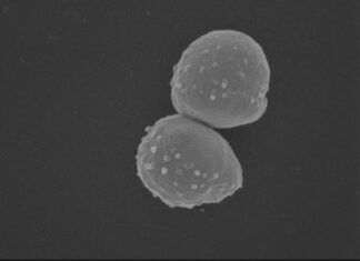 CPR im Labor: Jenaer Team kultiviert Grundwasser-Bakterien Forscher aus Jena reichern schwer kultivierbare CPR-Bakterien aus Grundwasser an. Neue Erkenntnisse zu Sauerstofftoleranz und Ökologie öffnen Forschungswege. Foto: Aufnahme eines Rasterelektronenmikroskops von winzigen Zellen aus Grundwasserproben, die im Labor kulturviert wurden (Quelle: Elektronenmikroskopisches Zentrum des UKJ, Dr. Martin Westermann und Susanne Lind