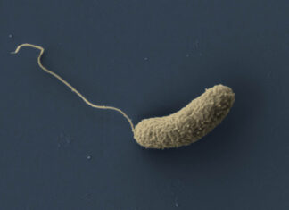 Uni Jena: Neue Erkenntnis zur Virusabwehr in Cholera-Bakterien FSU: Neue Erkenntnis zur Virusabwehr in Cholera-Bakterien. Foto: Elektronenmikroskopische Aufnahme eines Cholera-Erregers Vibrio cholerae (nachträglich koloriert). Abbildung: Kai Papenfort/Liana Franke-Opitz (Universität Jena)